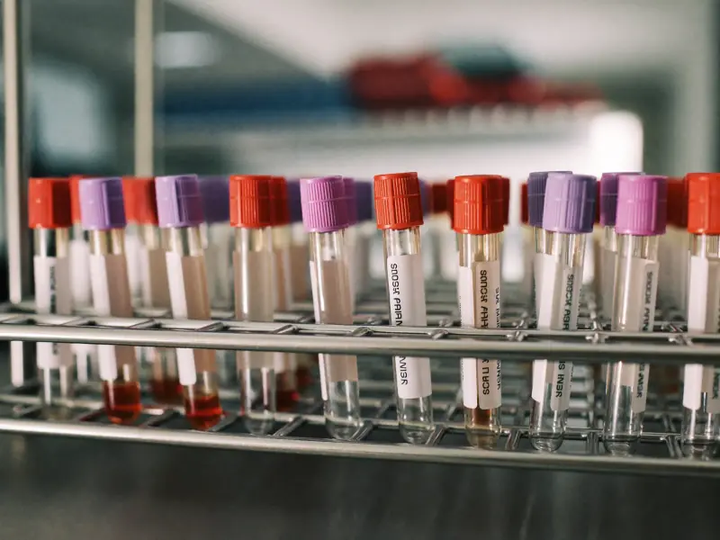 A rack of blood sample tubes in a bright laboratory.